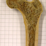 porous femur